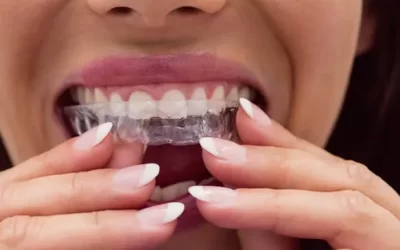 Invisalign Greensboro: Clear Aligner Therapy for Discreet Orthodontic Correction